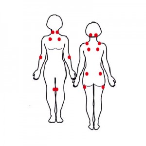 Fibro trigger points