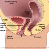 Update on IC and Vulvodynia:  3 Energy Science Solutions