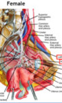 IC and Ways to Reduce Inflammation