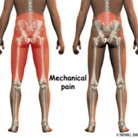 Low Back Pain and IC:  5 Energy Science Ways to Manage