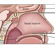 The Neti Pot and IC: How It Works Energetically